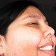 Photo of a cheek.